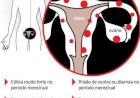 Endometriose: conheça as causas, sintomas e tratamento da doença que afeta 8 milhões de mulheres no Brasil